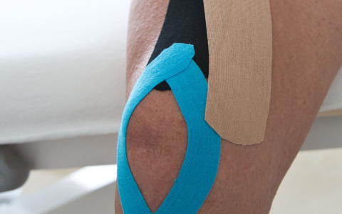 Kinesiotaping o vendaje neuromuscular