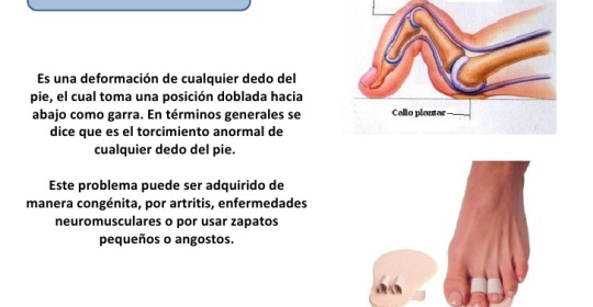 El hielo, un gran aliado de la fisioterapia y de tus lesiones